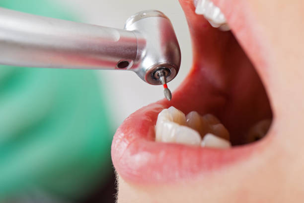 Best Emergency Root Canal Therapy in Walls, MS